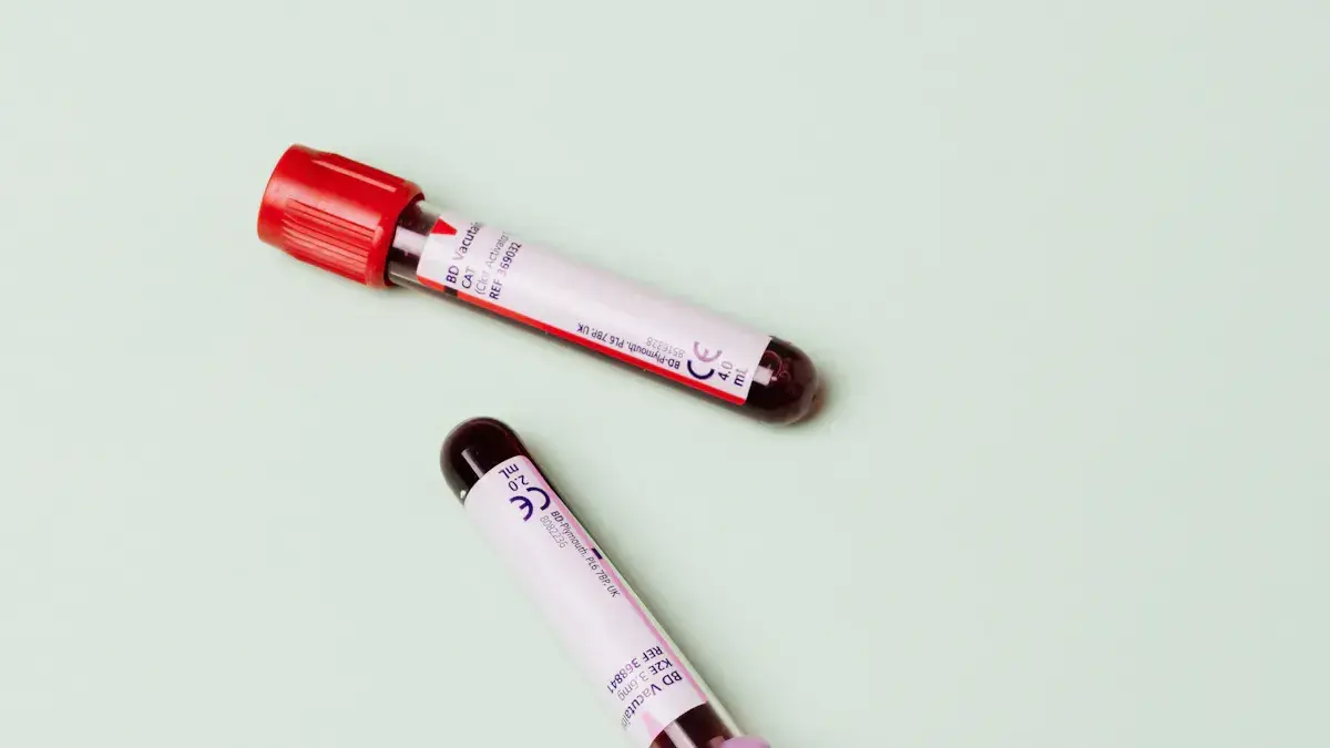 Feline Leukemia Virus Antigen Test.png