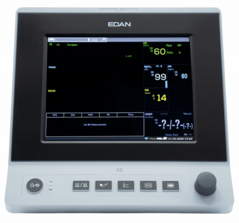 Edax X8 Veterinary Monitor