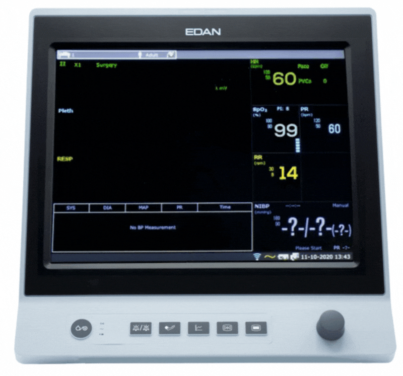 Edan X10 Veterinary Monitor