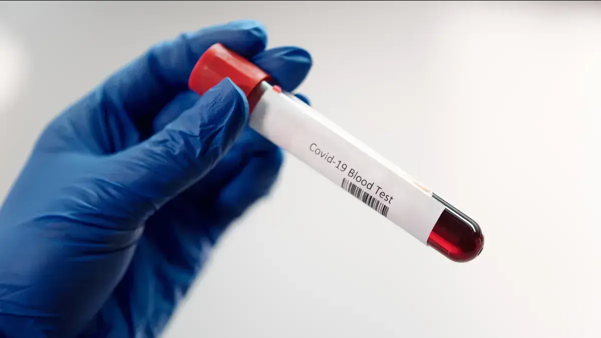 Infectious Disease Tests1.png