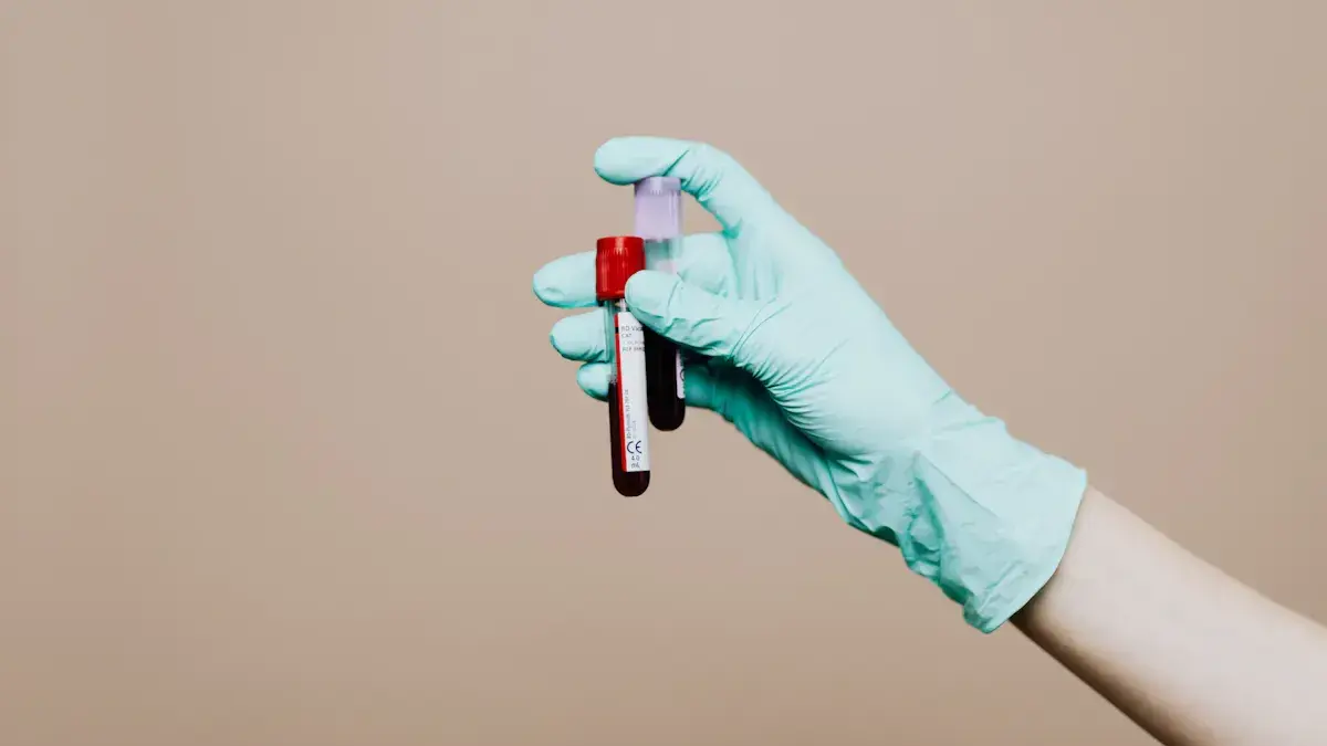 Feline Leukemia Virus Antigen Test8.png