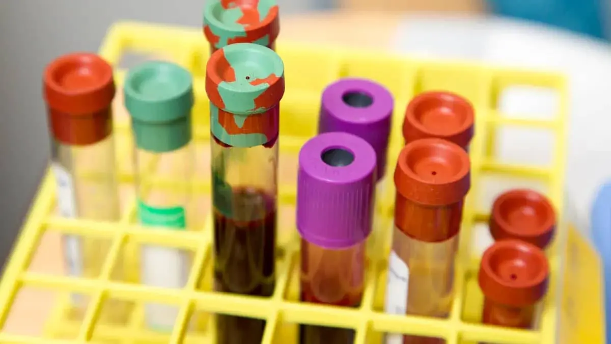 blood lab tests3.png